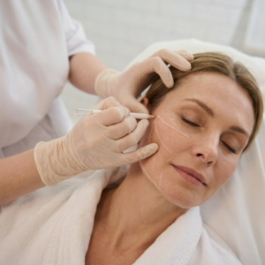 Bioestimuladores de Colágeno