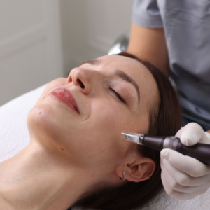 Microneedling / Dermapen
