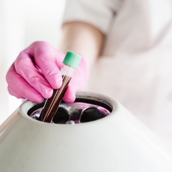 Plasma rico en plaquetas